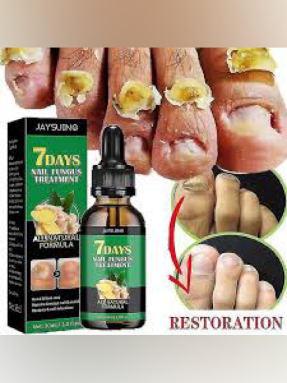 Jaysuing 7Days Nail‎ Fungus Treatment NEW/SEALED